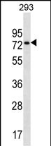 CCDC55 (N-term)