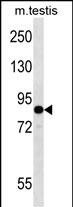 EIF2B5 (N-term)