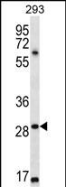 MESP1 (N-term)