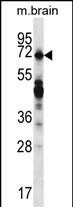 REPS2 (N-term)