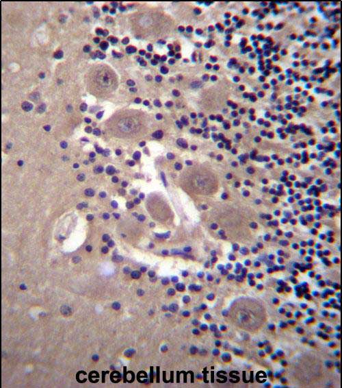 Rabbit Polyclonal Antibody to NPTXR