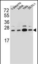 SSR2