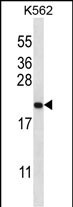 GAGE2B (N-term)