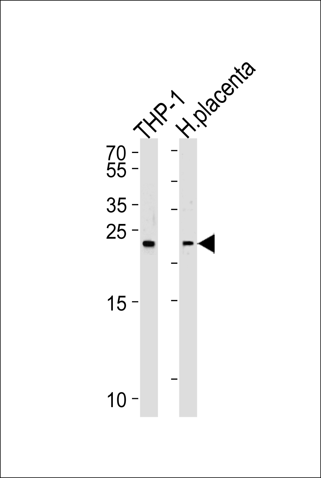 HEBP2 (N-term)