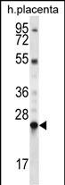 LHFPL1 (N-term)