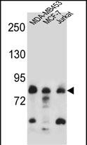AFG3L2 (N-term)