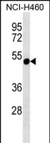 RTDR1 (N-term)