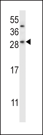 CHMP2B (N-term)