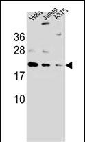 ARL6IP6 (N-term)