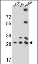 PGAM4 (N-term)