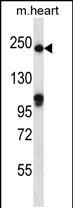 SLIT1 (N-term)