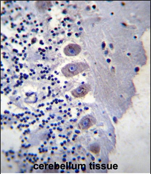 Rabbit Polyclonal Antibody to BEAN (N-term)
