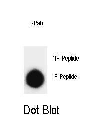 Phospho-SNAP25(T138)