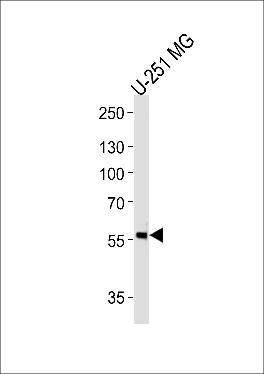 PHF17 (N-term)