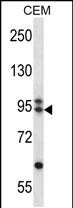 ARMC9 (N-term)