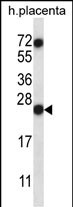 RNASE8