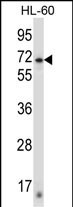 ZNF415 (N-term)