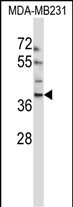 EMID1 (N-term)