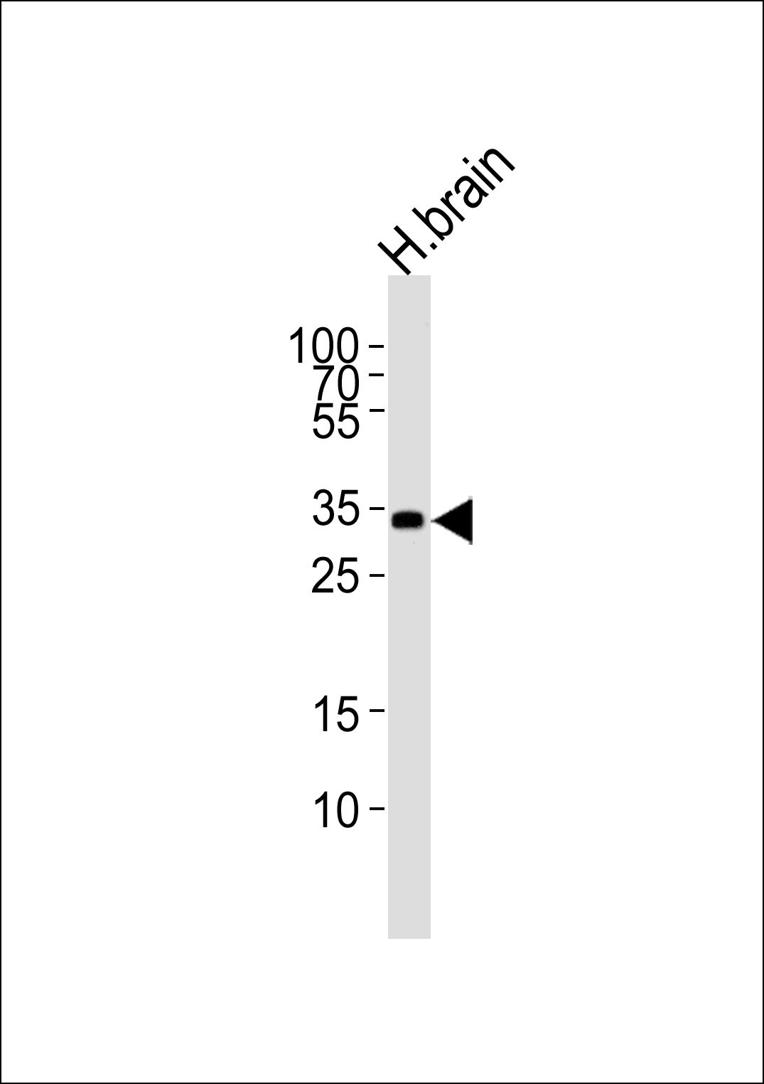 STMN4 (N-term)
