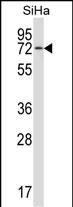 HSPA12B (N-term)