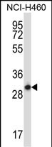 STX17 (N-term)