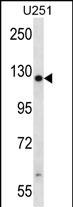 TTC13 (N-term)
