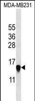 HIST2H2AA3 (N-term)