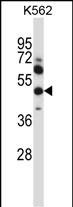 MMP13
