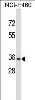 CELA3B (N-term)