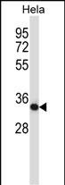 Mouse Csnk2a2 (N-term)