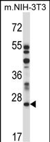 LAPTM4A (N-term)