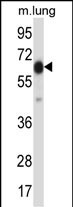 POF1B