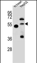 NOSTRIN