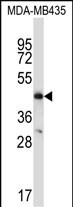 CCR9
