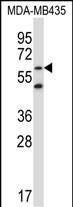 ZNF479 (N-term)