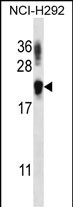 TTC33