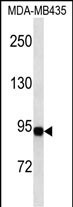 GSN (N-term)
