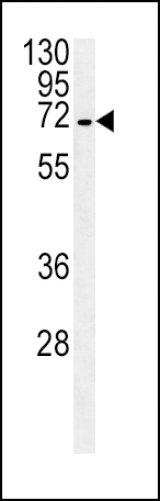 SLC22A1