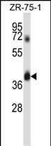 DPAGT1 (N-term)