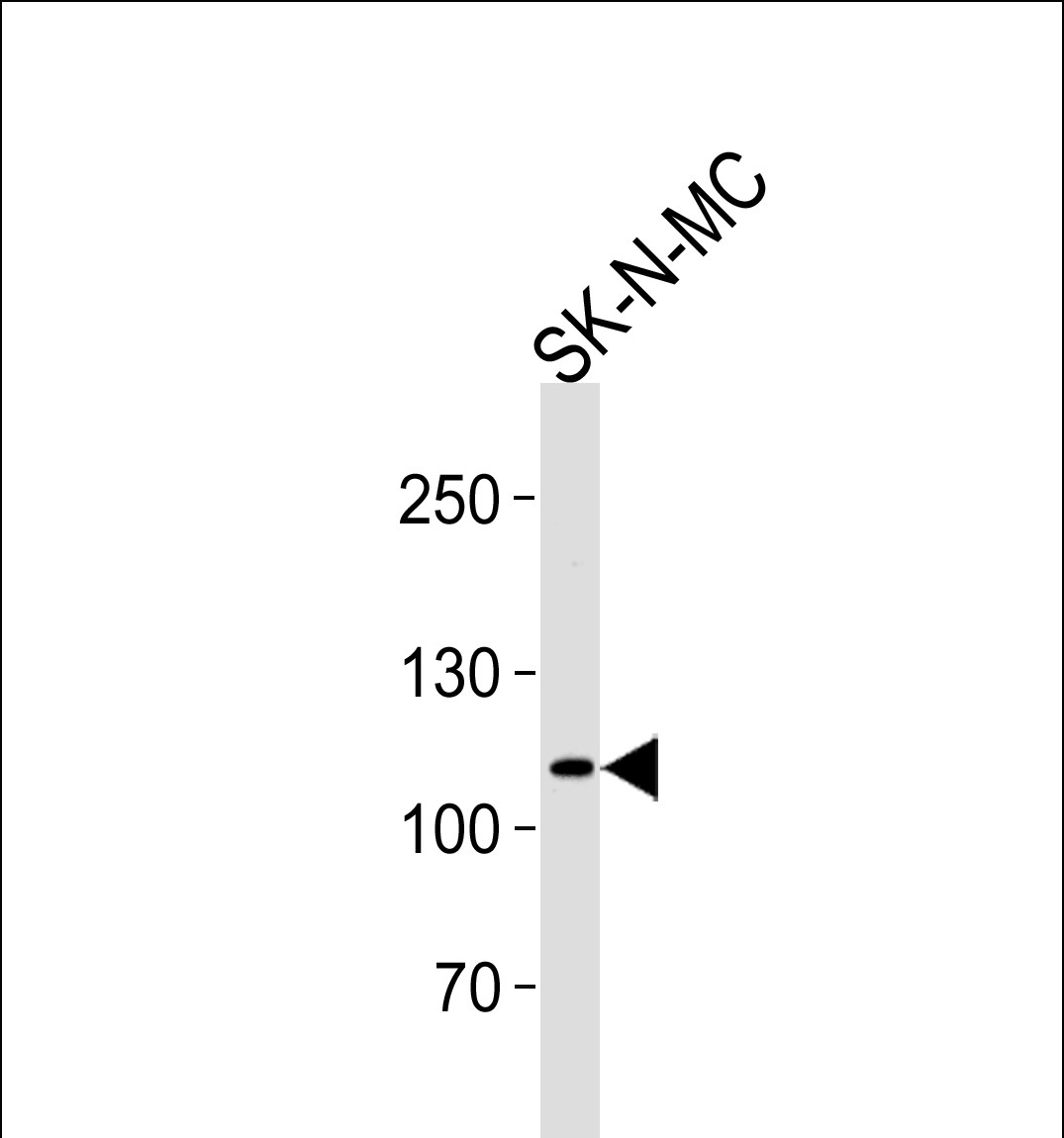 NOC3L (N-term)