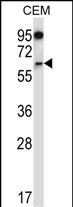 NOX4 (N-term)