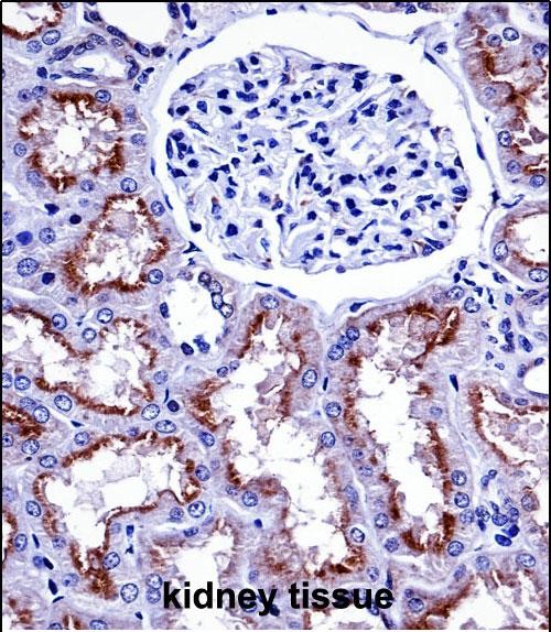 Rabbit Polyclonal Antibody to NOX4 (N-term)