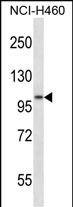 ADAM8 (N-term)