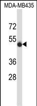 SPN/CD43 (N-term)