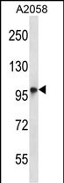 TMC6 (N-term)