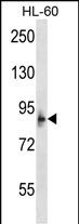 MCPH1 (N-term)