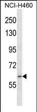 RNF19A