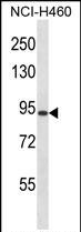 RGS9 (N-term)