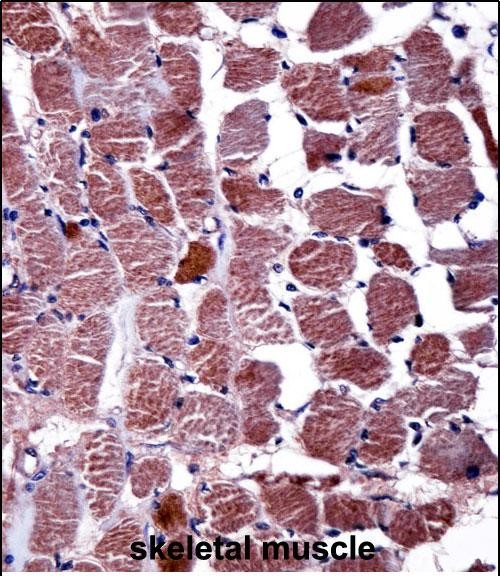 Rabbit Polyclonal Antibody to RGS9 (N-term)