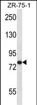 AGGF1 (N-term)
